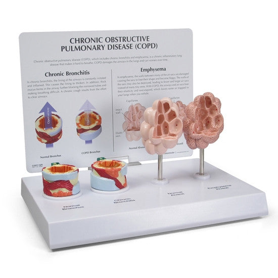 COPD Model (4 part)