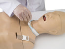 Switch Tracheostomy on the Suction/Tube Feeding Model 3 image