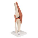 Switch Lateral View Of The Deluxe Functional Knee Joint Model 3B Scientific 1000164 2 image