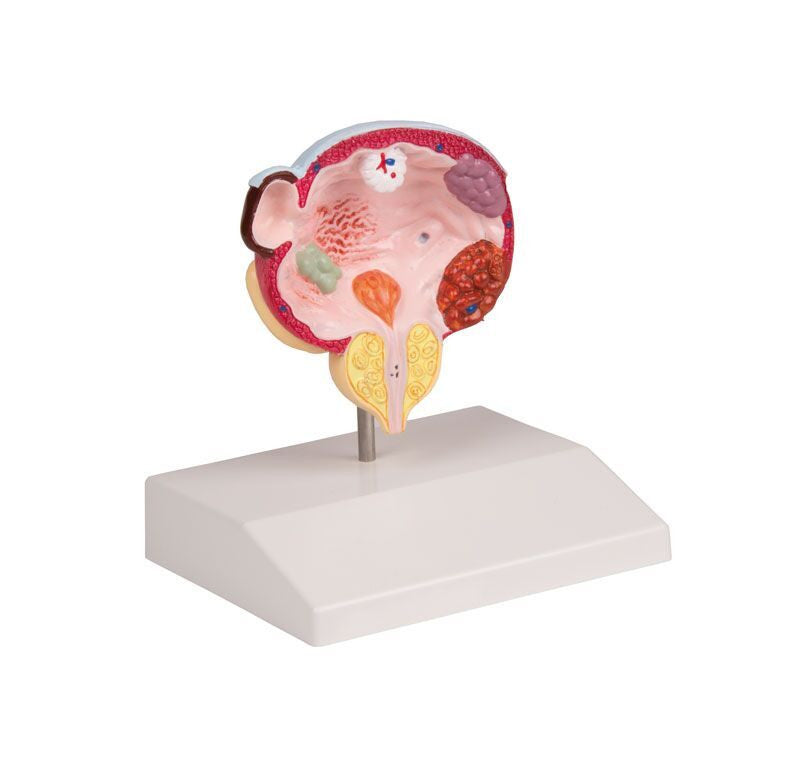 K243 Bladder diseases model