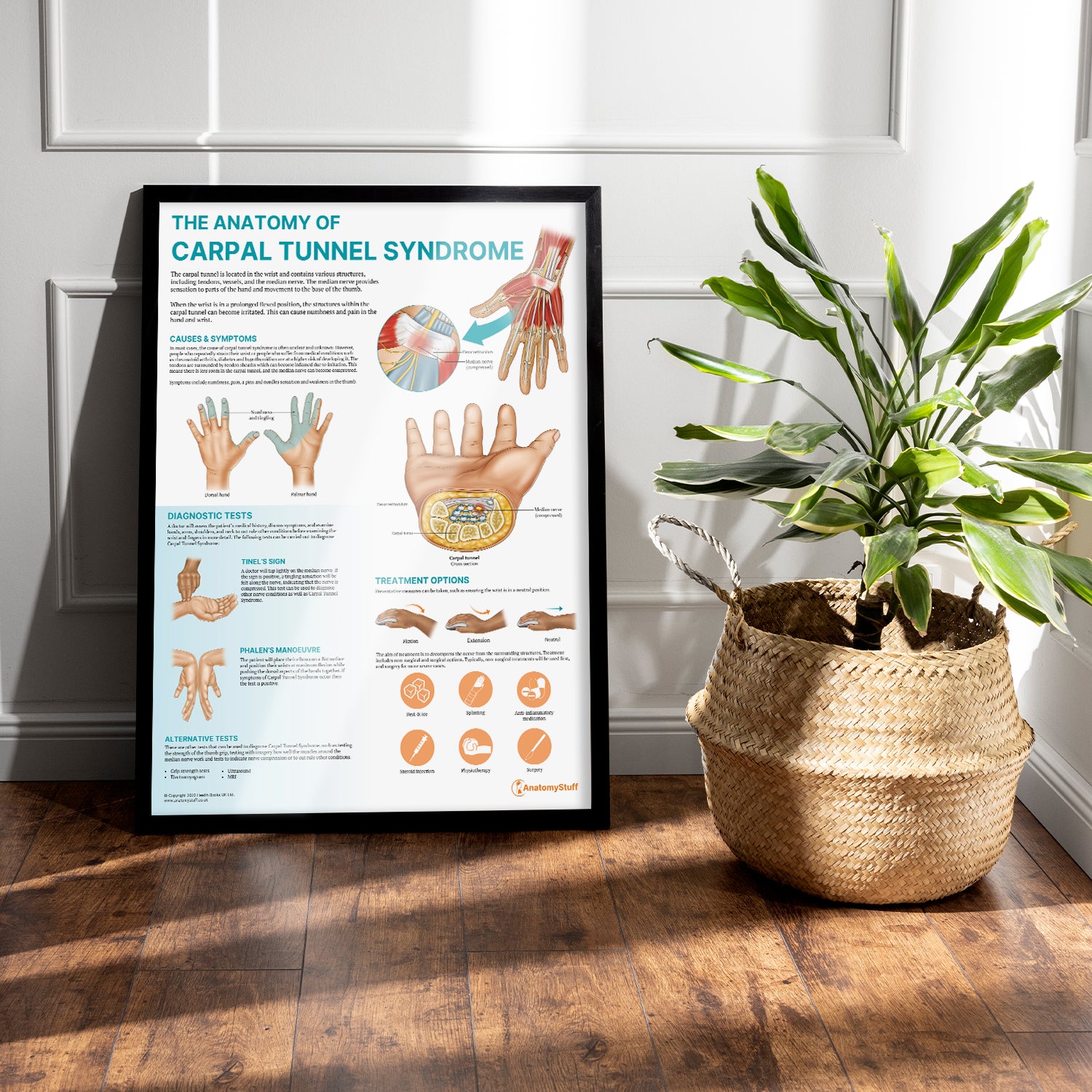 The Anatomy of Carpal Tunnel Syndrome Chart / Poster