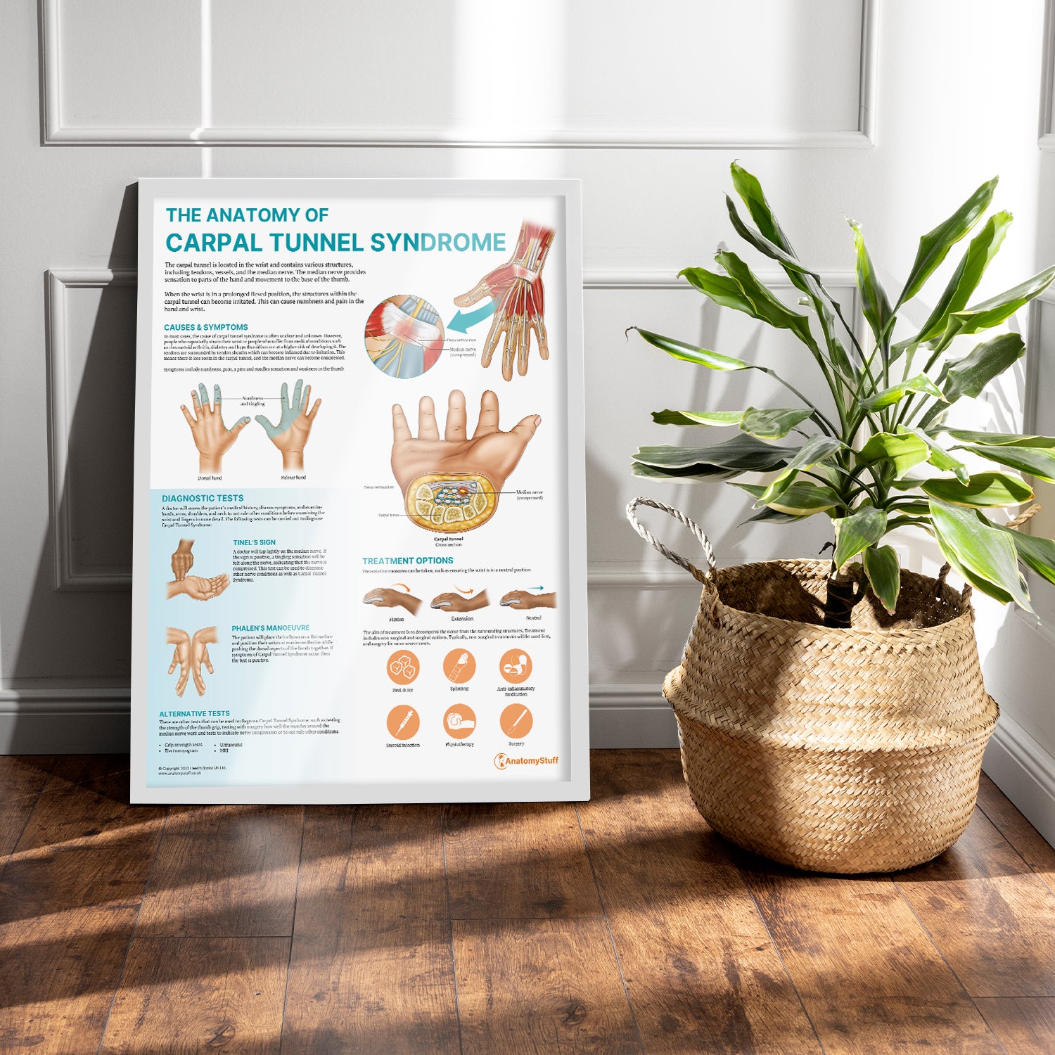 The Anatomy of Carpal Tunnel Syndrome Chart / Poster