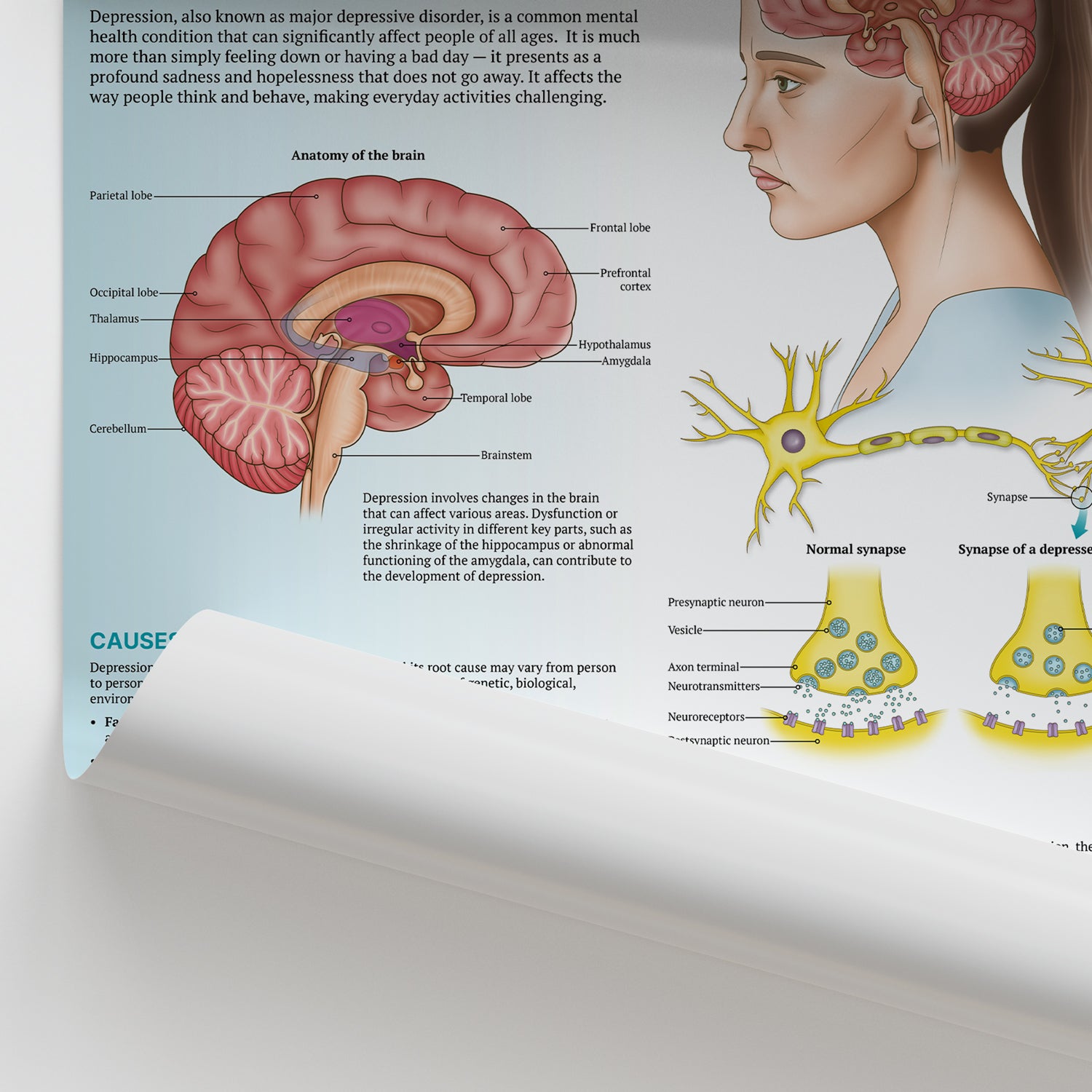 The Anatomy of Depression Chart / Poster