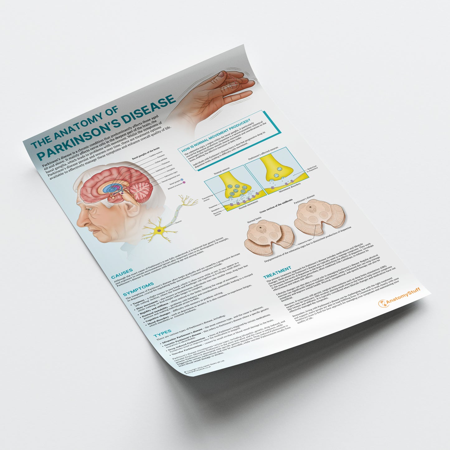 The Anatomy of Parkinson's Disease Chart / Poster