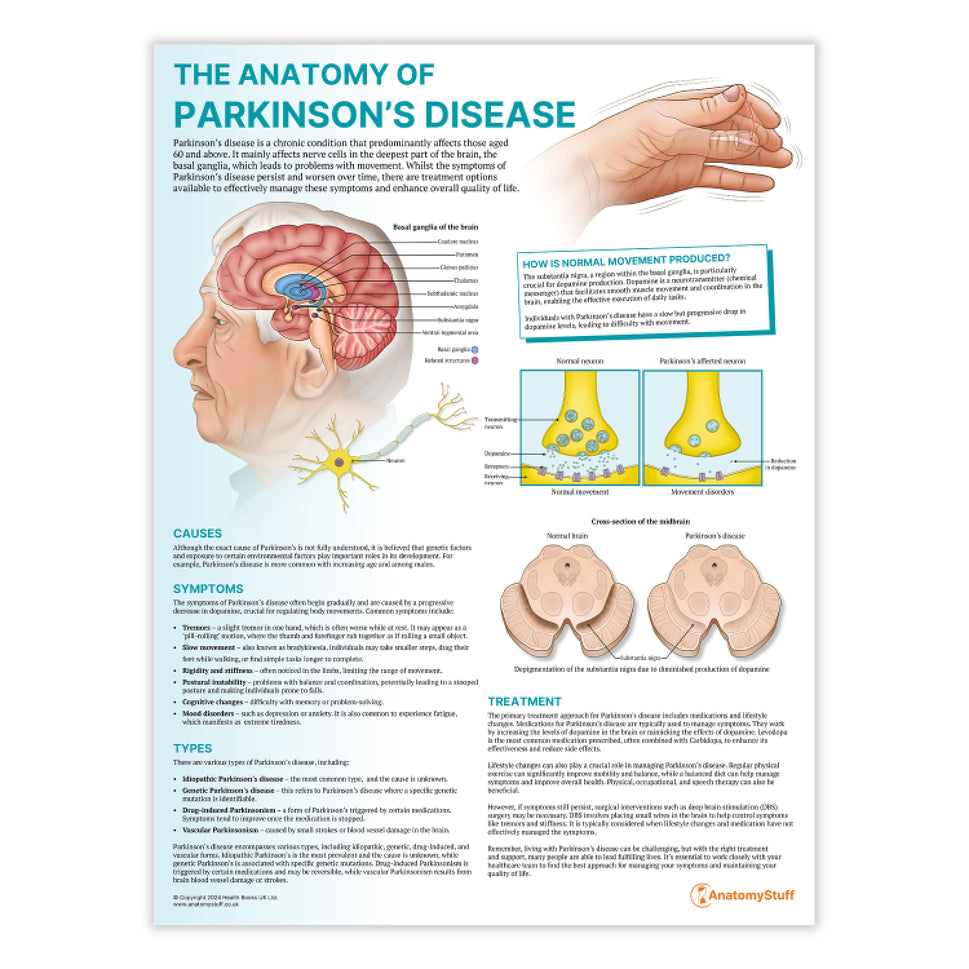 The Anatomy of Parkinson's Disease Chart / Poster