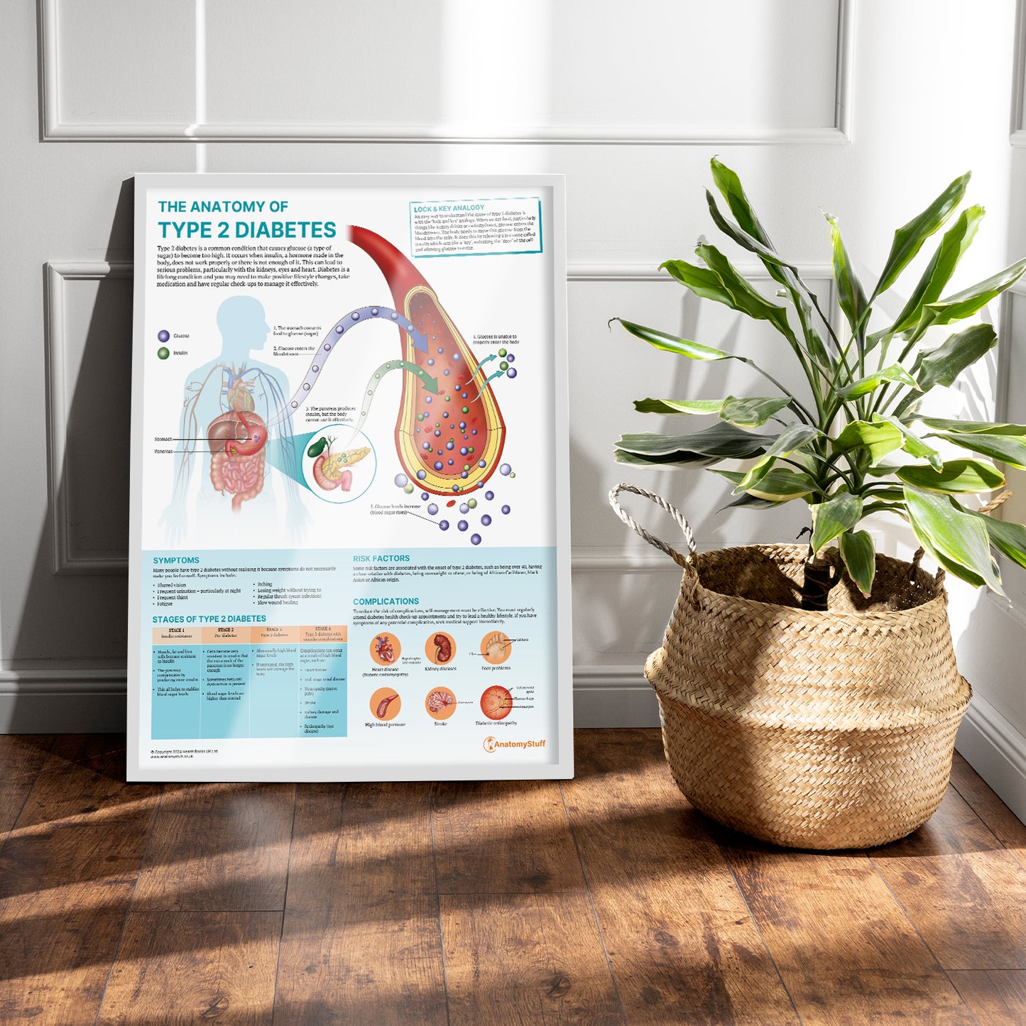 The Anatomy of Type 2 Diabetes Chart / Poster