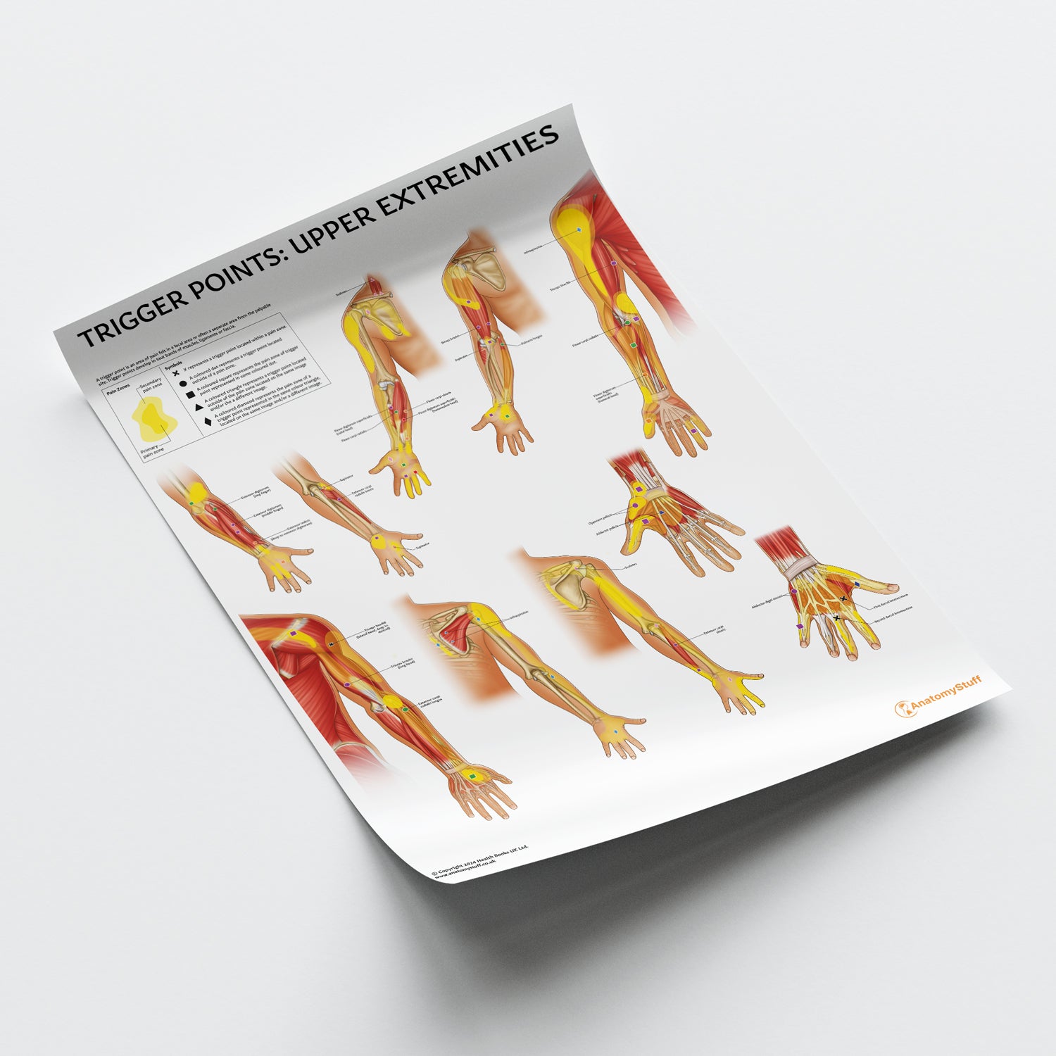 Trigger Points: Upper Extremities Chart / Poster