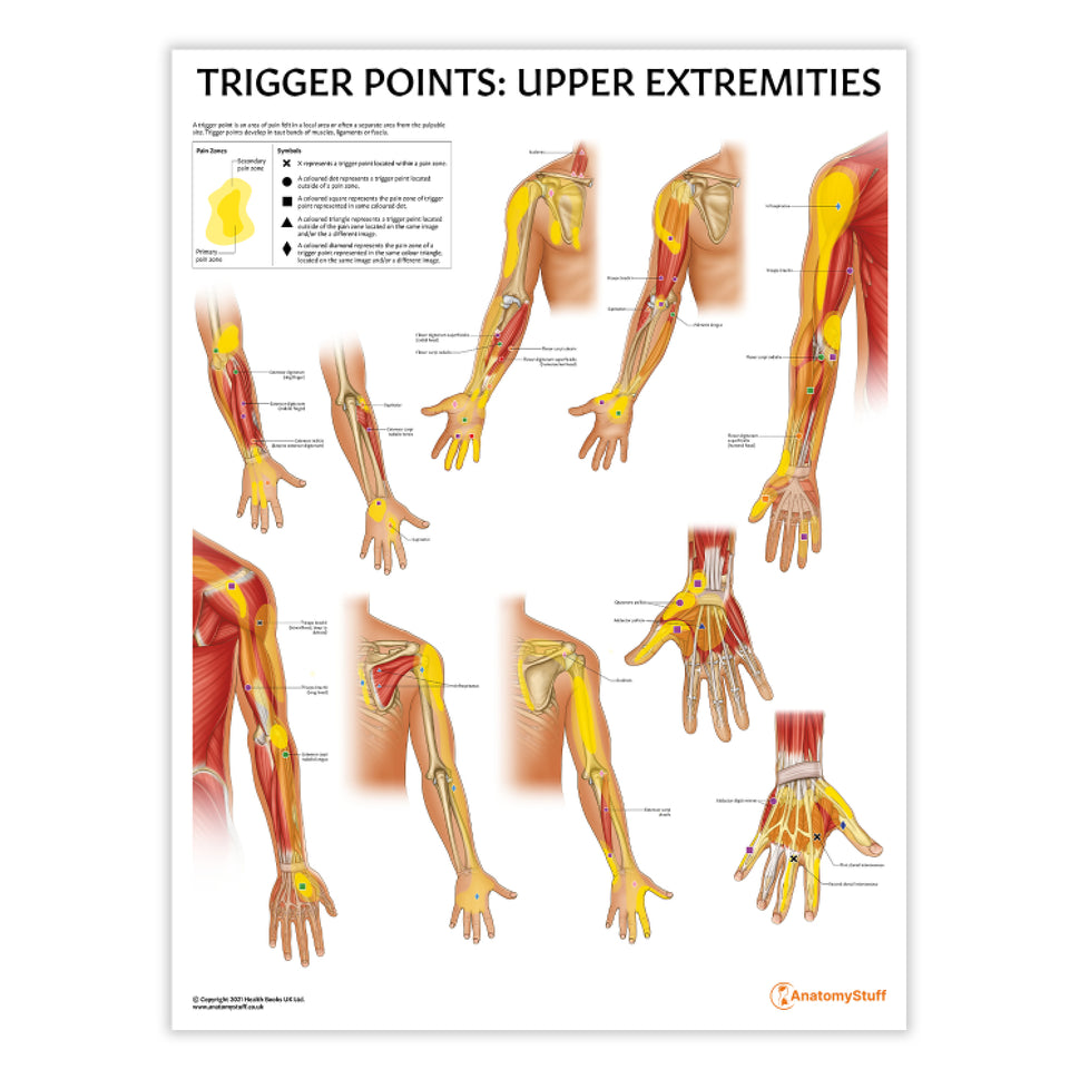 Trigger Points: Upper Extremities Chart / Poster